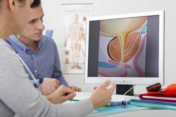 le médecin consulte le patient sur la question de la prostatite