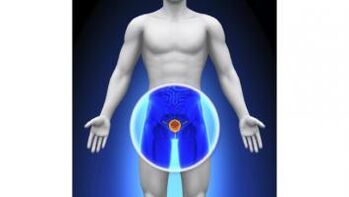 prostatite chez un homme